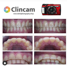 Load image into Gallery viewer, Clincam - Dental photography camera - Dental Photography Solutions