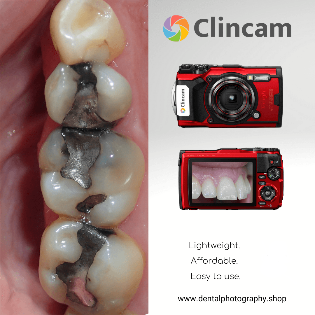 Clincam Dental photography camera - Main Image
