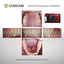 Load image into Gallery viewer, Clincam - Dental photography camera - Dental Photography Solutions