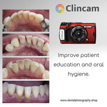 Load image into Gallery viewer, Clincam - Dental photography camera - Dental Photography Solutions