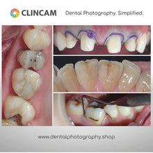 Load image into Gallery viewer, Clincam - Dental photography camera - Dental Photography Solutions
