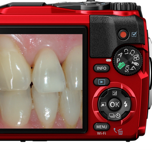 dental photography, dentist camera, clinical images, aesthetic dentistry, clincam, orthodontics, veneers, dental students, implants, orthodontists, photos, teeth, dental, dentistry, cosmetic dentistry, tooth whitening, straight teeth, smiles, lips, cheeks