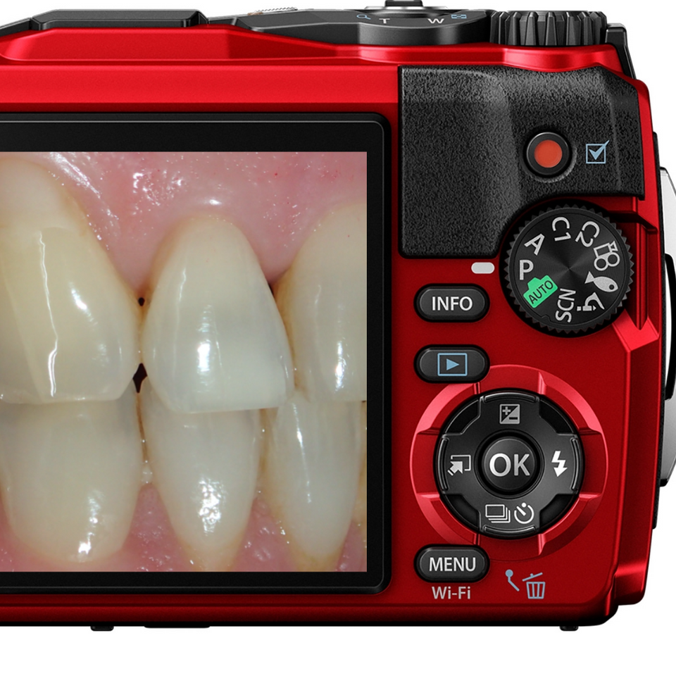 dental photography, dentist camera, clinical images, aesthetic dentistry, clincam, orthodontics, veneers, dental students, implants, orthodontists, photos, teeth, dental, dentistry, cosmetic dentistry, tooth whitening, straight teeth, smiles, lips, cheeks