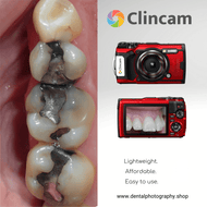 Clincam - Dental photography camera - Dental Photography Solutions