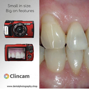 Clincam - Dental photography camera - Dental Photography Solutions