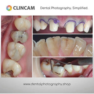 Clincam - Dental photography camera - Dental Photography Solutions